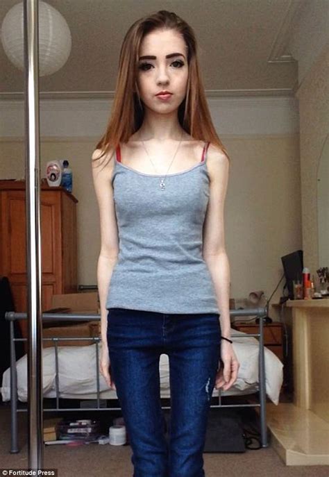 teenage girl in a counseling session - <b>anorexic</b> teen stock pictures, royalty-free photos & images. . Anorexic nude teens